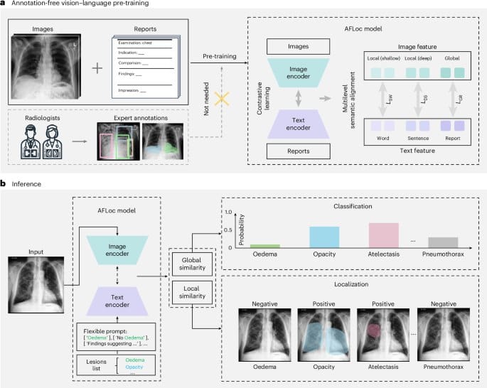 中国团队开发 AFLoc 模型，实现无标注病理定位技术突破