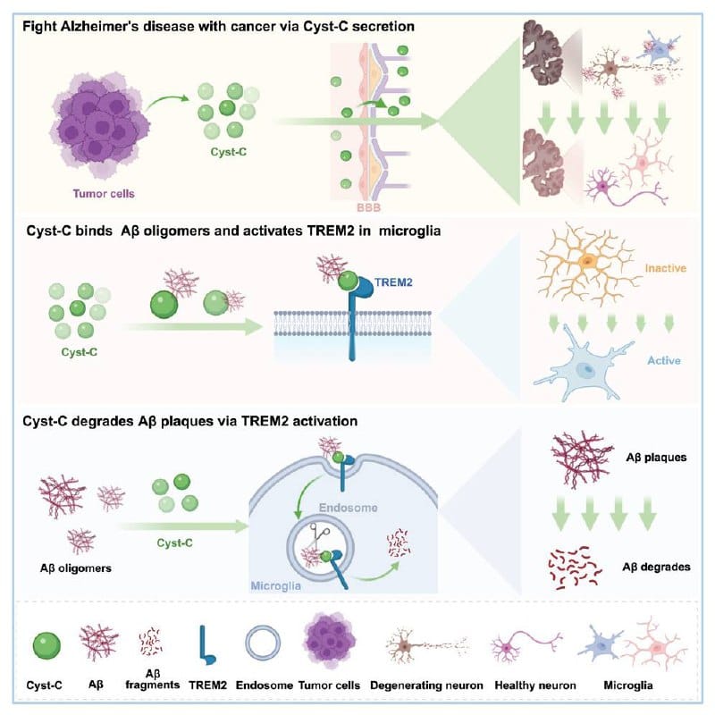 研究提示癌症与阿尔茨海默病风险下降相关：关键蛋白或起作用
